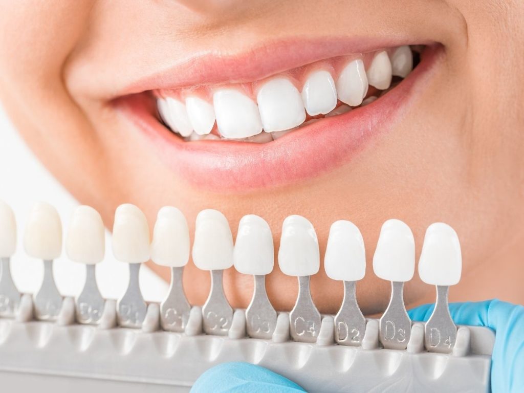 BEST Porcelain Veneers Near You in Grande Prairie Alberta - Over 20 ...